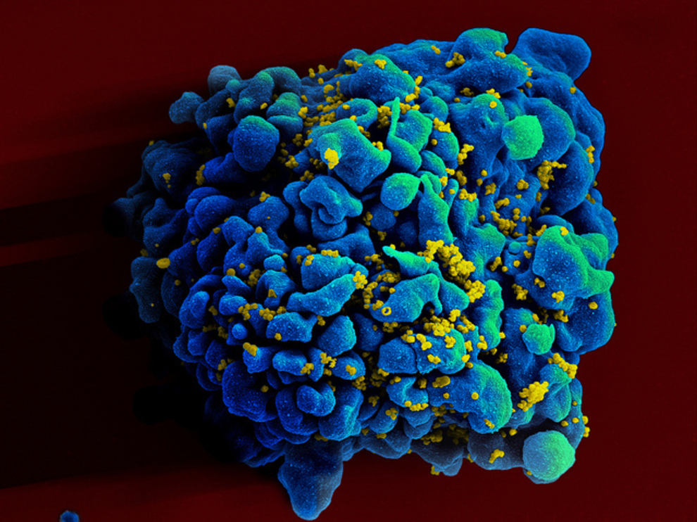 Imagen de un escáner electromicrográfico de un linfocito T infectado por el VIH