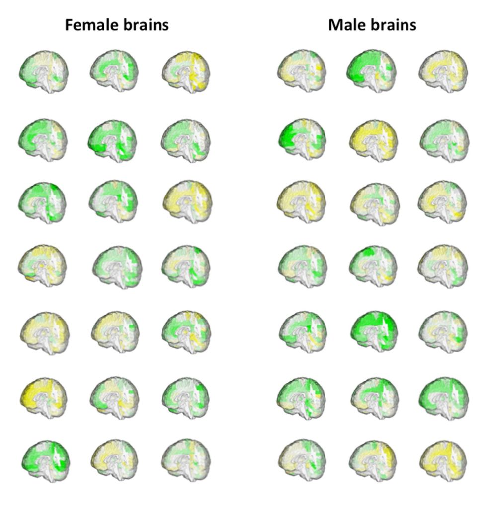 El volumen de las distintas regiones cerebrales (en verde, más grande y en amarillo, más pequeña) de 42 personas muestra cómo se solapan el cerebro masculino y el femenino